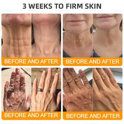 Made and Shipped from AUS ✨✨ APKAPK® Bee venom Comprehensive Cream 🔥 Sagging Skin, Fine Lines, Loss of Firmness, Flat Bust, Drooping Hips, and More💎💎