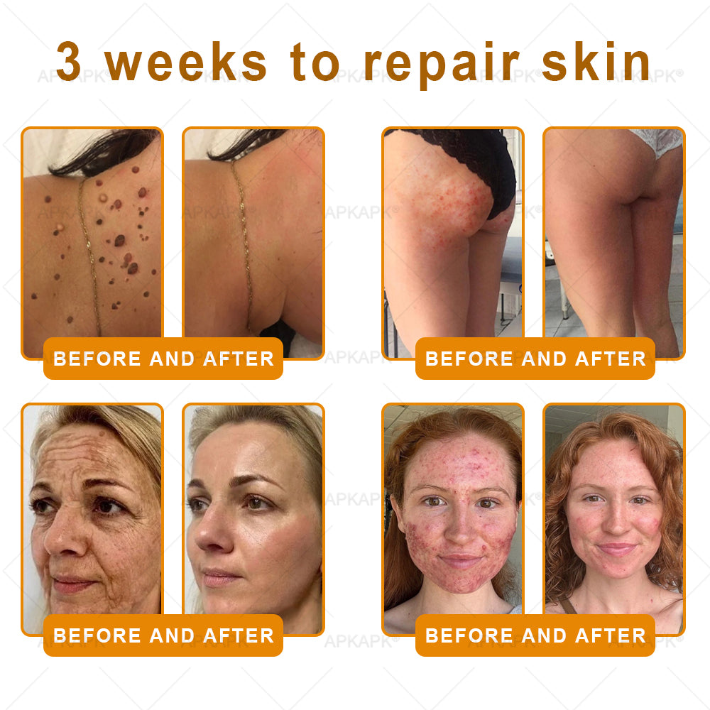 Made and Shipped from Australia 🫧𝖠𝖯𝖪𝖠𝖯𝖪® 𝖡𝖾𝖾 𝗏𝖾𝗇𝗈𝗆 𝖲𝗄𝗂𝗇 𝖱𝖾𝗌𝗍𝗈𝗋𝖺𝗍𝗂𝗈𝗇 𝖢𝗋𝖾𝖺𝗆