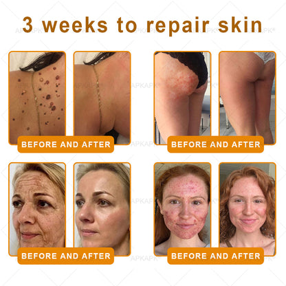 Made and Shipped from Australia 🫧𝖠𝖯𝖪𝖠𝖯𝖪® 𝖡𝖾𝖾 𝗏𝖾𝗇𝗈𝗆 𝖲𝗄𝗂𝗇 𝖱𝖾𝗌𝗍𝗈𝗋𝖺𝗍𝗂𝗈𝗇 𝖢𝗋𝖾𝖺𝗆