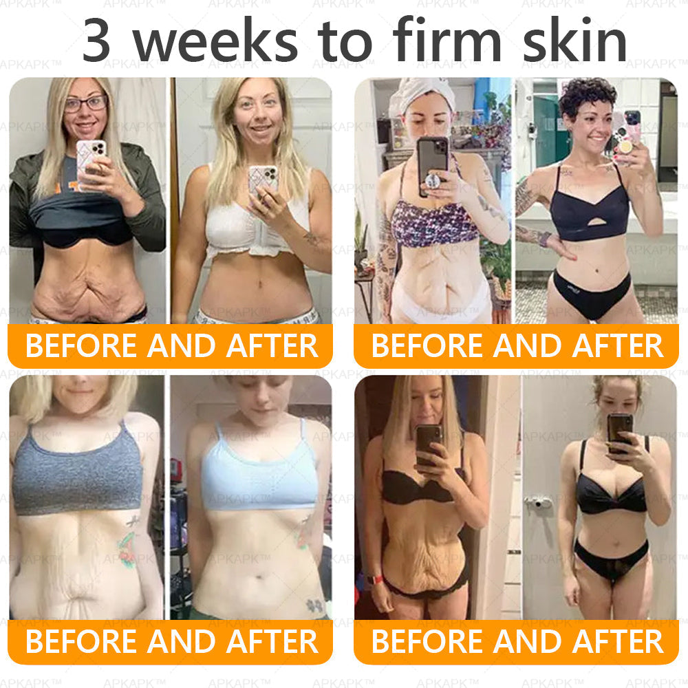 Made and Shipped from Australia 🫧𝖠𝖯𝖪𝖠𝖯𝖪® 𝖡𝖾𝖾 𝗏𝖾𝗇𝗈𝗆 𝖲𝗄𝗂𝗇 𝖱𝖾𝗌𝗍𝗈𝗋𝖺𝗍𝗂𝗈𝗇 𝖢𝗋𝖾𝖺𝗆