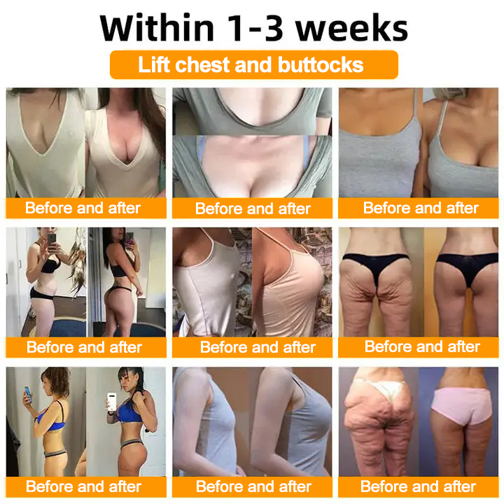 Made and Shipped from AUS ✨✨ APKAPK® Bee venom Comprehensive Cream 🔥 Sagging Skin, Fine Lines, Loss of Firmness, Flat Bust, Drooping Hips, and More💎💎