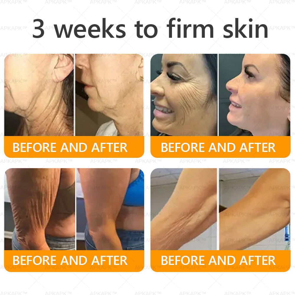 Made and Shipped from Australia 🫧𝖠𝖯𝖪𝖠𝖯𝖪® 𝖡𝖾𝖾 𝗏𝖾𝗇𝗈𝗆 𝖲𝗄𝗂𝗇 𝖱𝖾𝗌𝗍𝗈𝗋𝖺𝗍𝗂𝗈𝗇 𝖢𝗋𝖾𝖺𝗆