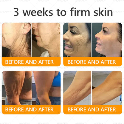 Made and Shipped from Australia 🫧𝖠𝖯𝖪𝖠𝖯𝖪® 𝖡𝖾𝖾 𝗏𝖾𝗇𝗈𝗆 𝖲𝗄𝗂𝗇 𝖱𝖾𝗌𝗍𝗈𝗋𝖺𝗍𝗂𝗈𝗇 𝖢𝗋𝖾𝖺𝗆