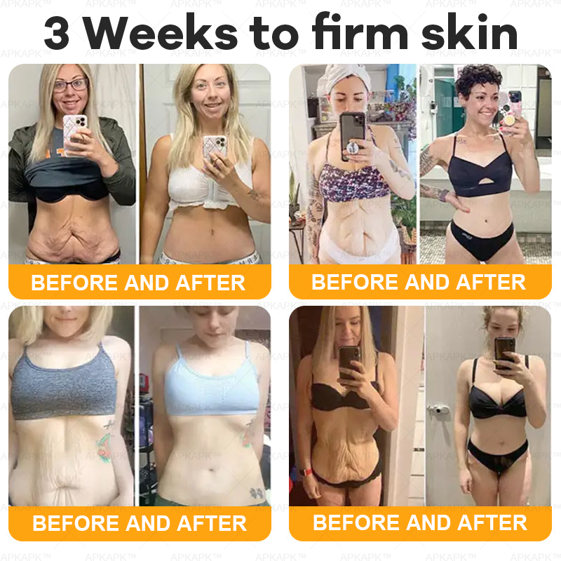 Made and Shipped from AUS ✨✨ APKAPK® Bee venom Comprehensive Cream 🔥 Sagging Skin, Fine Lines, Loss of Firmness, Flat Bust, Drooping Hips, and More💎💎