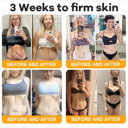 Made and Shipped from AUS ✨✨ APKAPK® Bee venom Comprehensive Cream 🔥 Sagging Skin, Fine Lines, Loss of Firmness, Flat Bust, Drooping Hips, and More💎💎