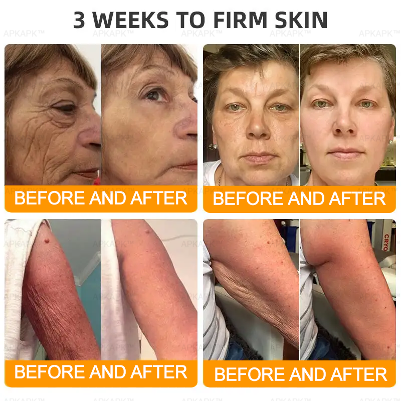 Made and Shipped from AUS ✨✨ APKAPK® Bee venom Comprehensive Cream 🔥 Sagging Skin, Fine Lines, Loss of Firmness, Flat Bust, Drooping Hips, and More💎💎