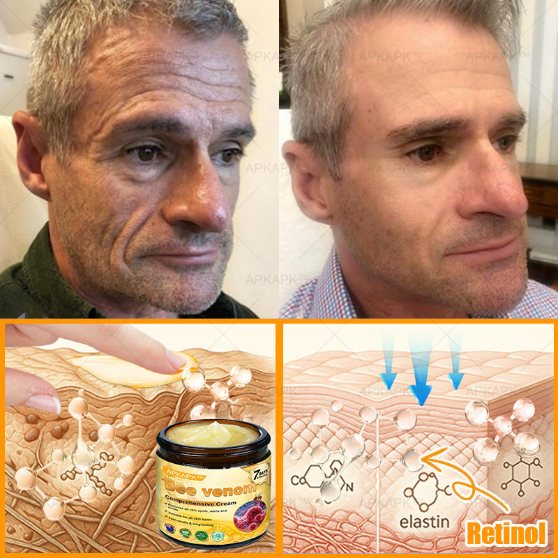 Made and Shipped from AUS ✨✨ APKAPK® Bee venom Comprehensive Cream 🔥 Sagging Skin, Fine Lines, Loss of Firmness, Flat Bust, Drooping Hips, and More💎💎