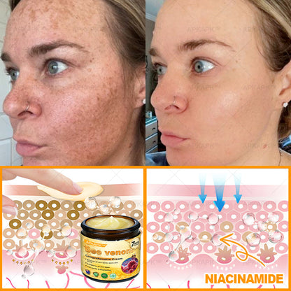 Made and Shipped from AUS ✨✨ APKAPK® Bee venom Comprehensive Cream 🔥 Sagging Skin, Fine Lines, Loss of Firmness, Flat Bust, Drooping Hips, and More💎💎