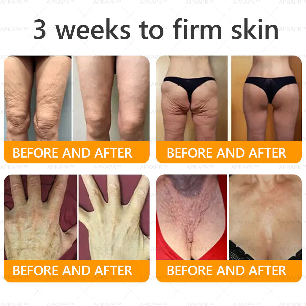 Made and Shipped from Australia 🫧𝖠𝖯𝖪𝖠𝖯𝖪® 𝖡𝖾𝖾 𝗏𝖾𝗇𝗈𝗆 𝖲𝗄𝗂𝗇 𝖱𝖾𝗌𝗍𝗈𝗋𝖺𝗍𝗂𝗈𝗇 𝖢𝗋𝖾𝖺𝗆