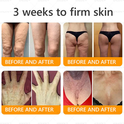 Made and Shipped from Australia 🫧𝖠𝖯𝖪𝖠𝖯𝖪® 𝖡𝖾𝖾 𝗏𝖾𝗇𝗈𝗆 𝖲𝗄𝗂𝗇 𝖱𝖾𝗌𝗍𝗈𝗋𝖺𝗍𝗂𝗈𝗇 𝖢𝗋𝖾𝖺𝗆