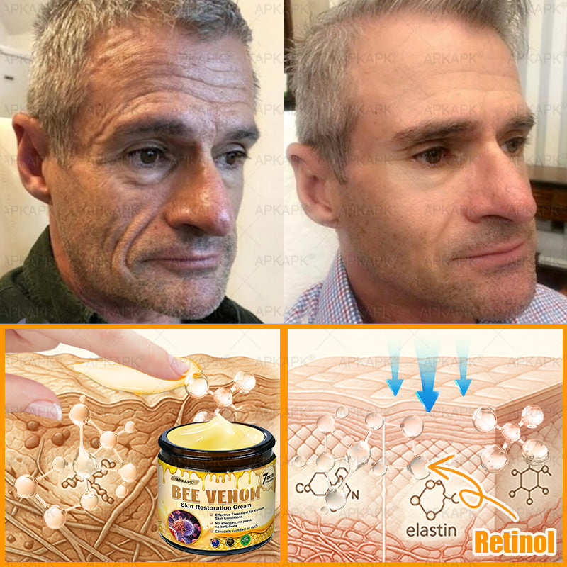 Made and Shipped from Australia 🫧𝖠𝖯𝖪𝖠𝖯𝖪® 𝖡𝖾𝖾 𝗏𝖾𝗇𝗈𝗆 𝖲𝗄𝗂𝗇 𝖱𝖾𝗌𝗍𝗈𝗋𝖺𝗍𝗂𝗈𝗇 𝖢𝗋𝖾𝖺𝗆