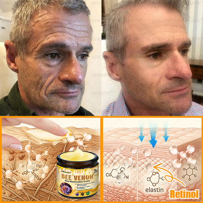 Made and Shipped from Australia 🫧𝖠𝖯𝖪𝖠𝖯𝖪® 𝖡𝖾𝖾 𝗏𝖾𝗇𝗈𝗆 𝖲𝗄𝗂𝗇 𝖱𝖾𝗌𝗍𝗈𝗋𝖺𝗍𝗂𝗈𝗇 𝖢𝗋𝖾𝖺𝗆